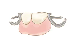 保険適用の部分入れ歯